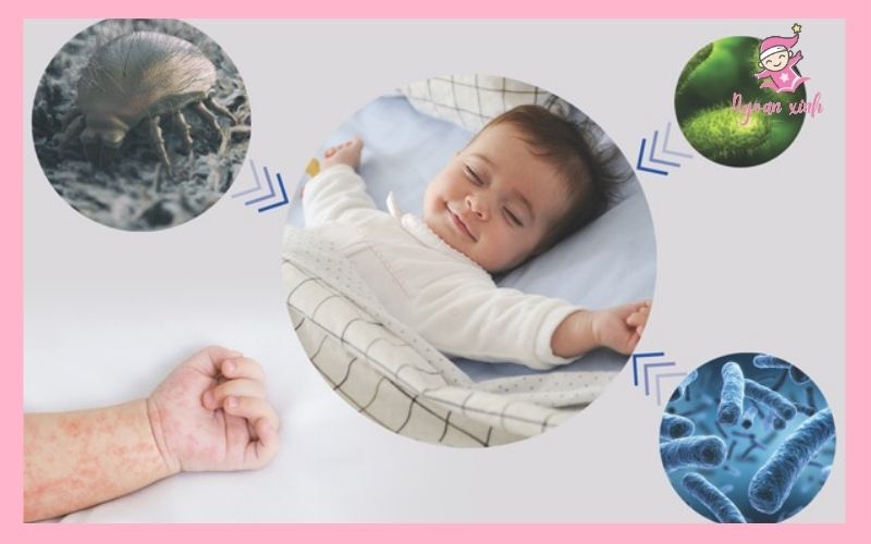 sứa tắm diệt khuẩn cho bé